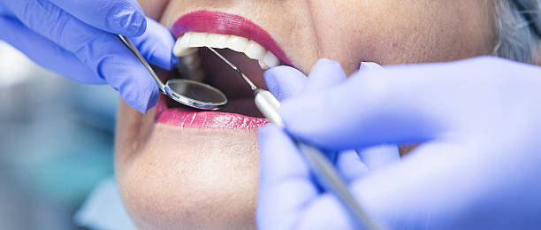 Best Emergency Treatment for Dental Infections or Abscesses in Ivanhoe, CA